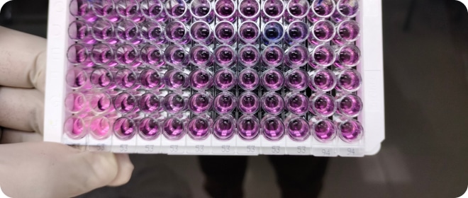 enzyme-linked-immunosorbent-assay-elisa-plate-immunology-serology-testing-method-laboratory (1)
