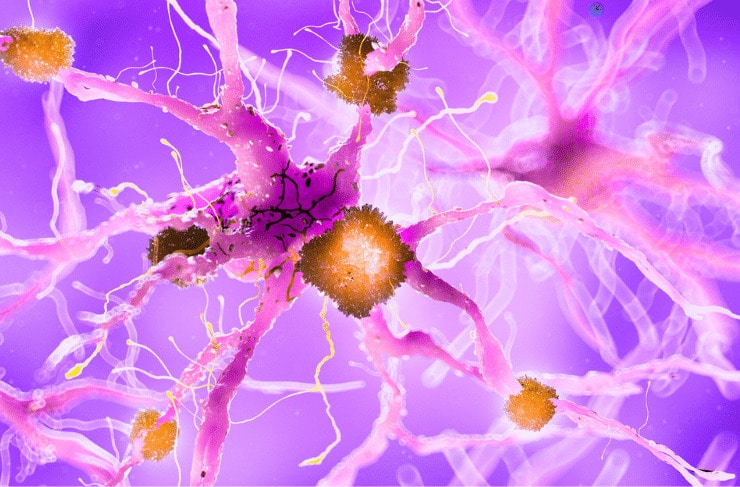 Disease-States-740x487-1
